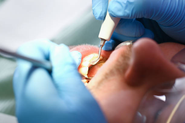 Best Emergency Tooth Extraction  in Newport News, VA