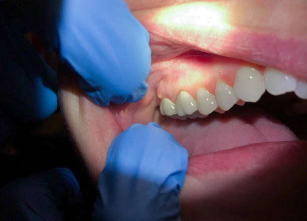 Best Urgent Tooth Repair  in Newport News, VA